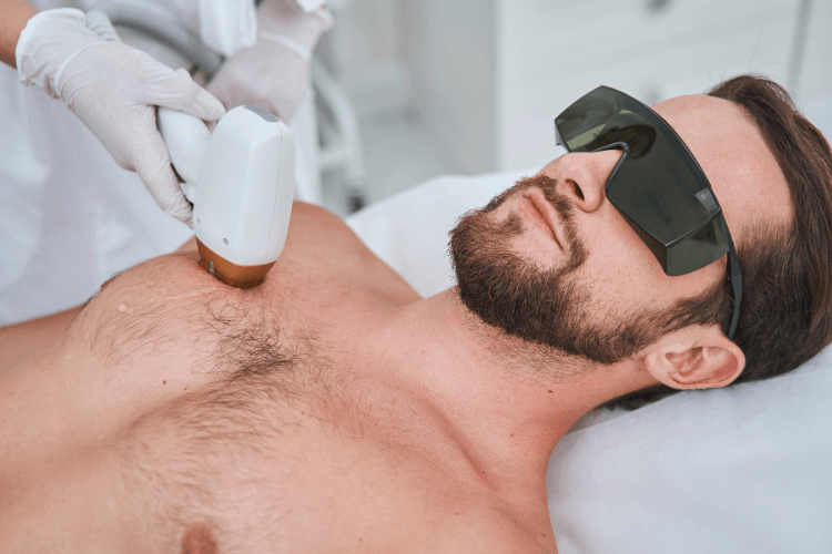 Laserontharing voor mannen bij Let’s Laser